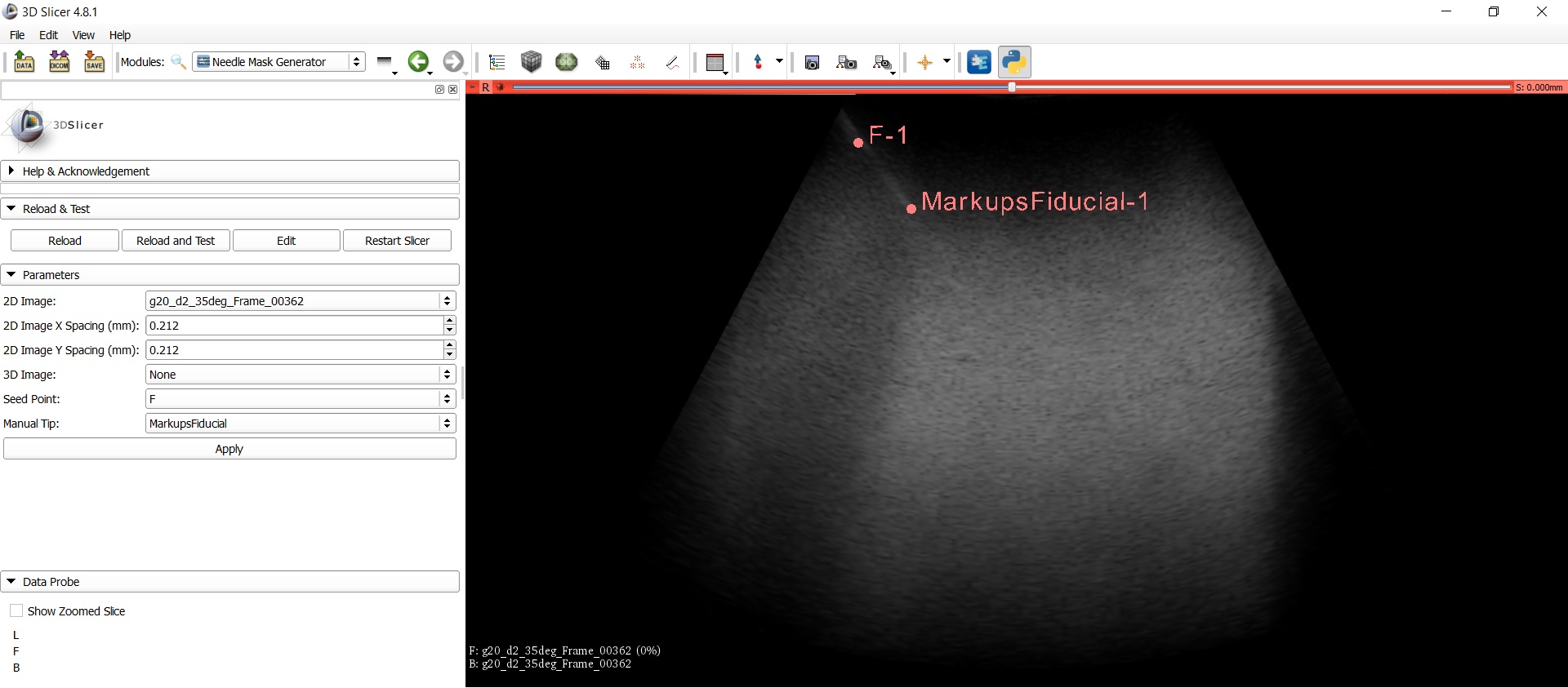 Inputs to the module are an ultrasound image with a point on the shaft and a point on the tip