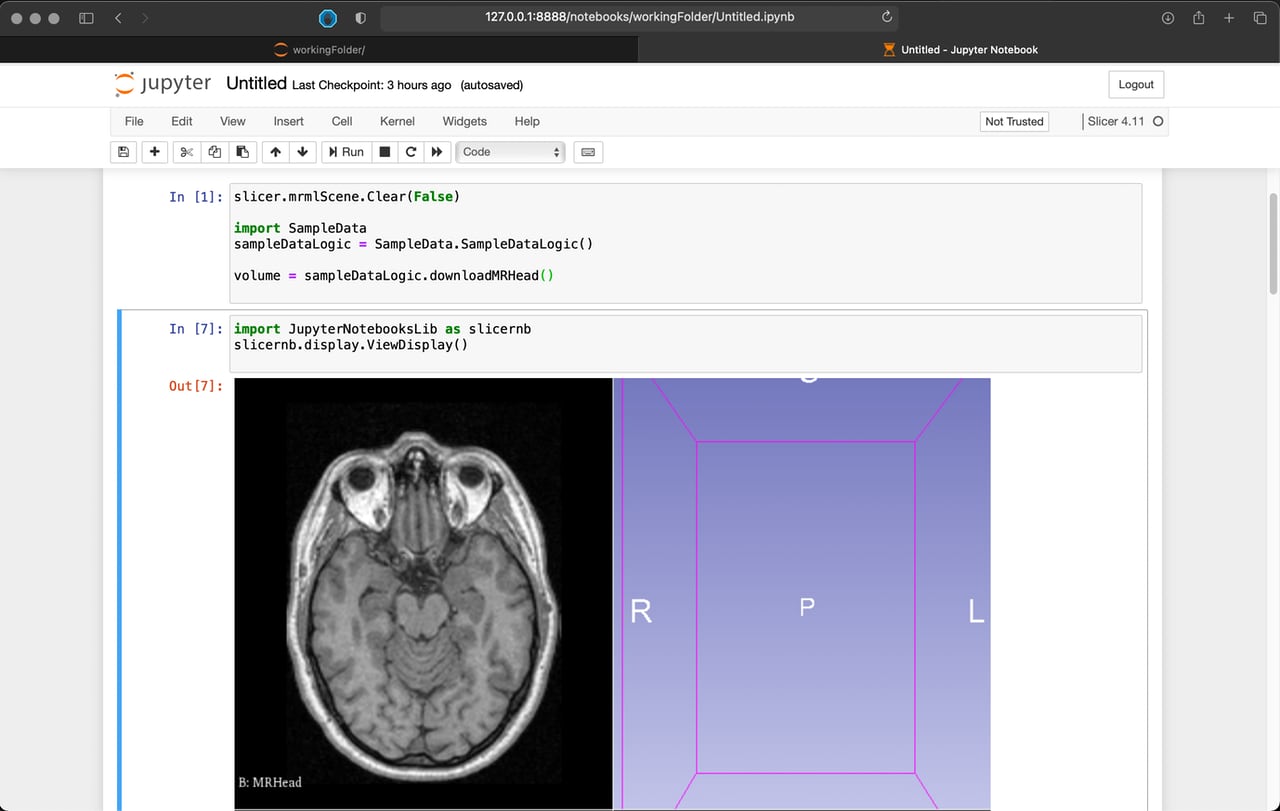 Slicer Jupyter